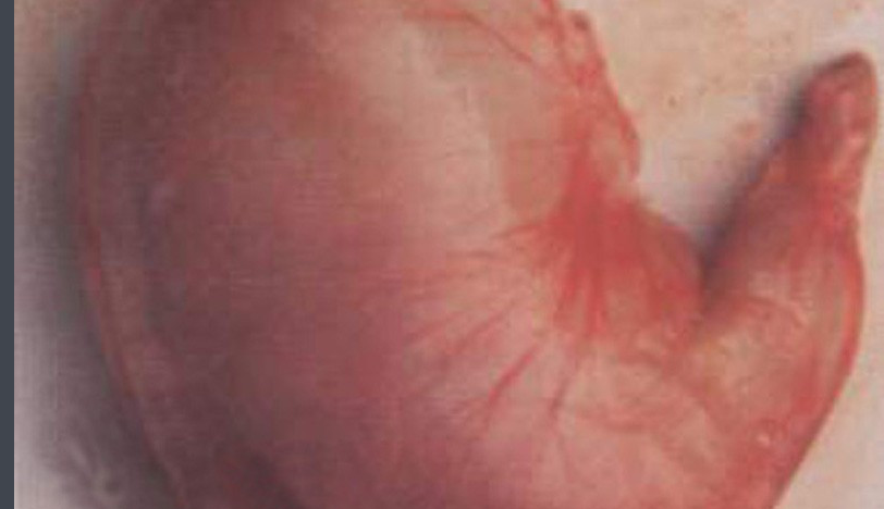 猪传染性胃肠炎